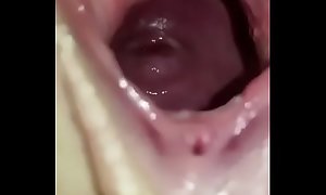 Yon open pussy low cervix