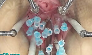 Extreme German BDSM Flappable inner Cum-hole Cervix enhanced by Tits